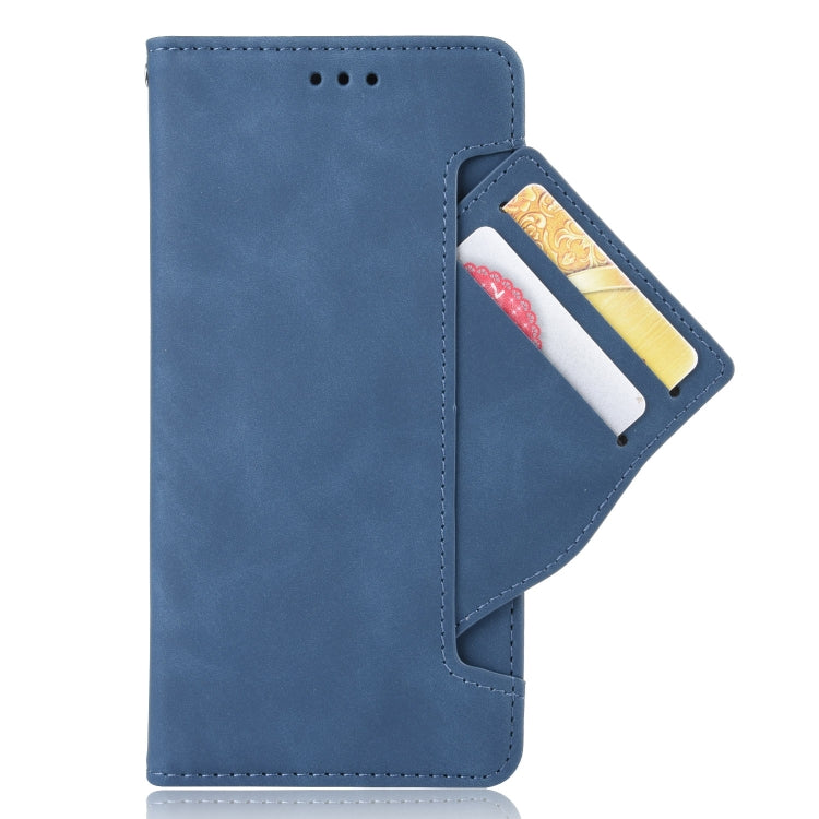 For Ulefone Note 12P Skin Feel Calf Pattern Leather Phone Case(Blue) - Ulefone Cases by buy2fix | Online Shopping UK | buy2fix