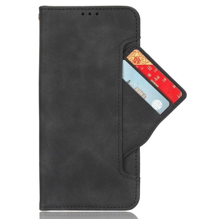 For Sony Xperia 1 VI 2024 Skin Feel Calf Texture Card Slots Leather Phone Case(Black) - Sony Cases by buy2fix | Online Shopping UK | buy2fix