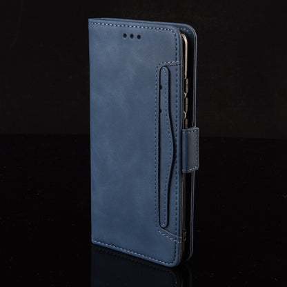 For Sony Xperia 10 VI 2024 Skin Feel Calf Texture Card Slots Leather Phone Case(Blue) - Sony Cases by buy2fix | Online Shopping UK | buy2fix