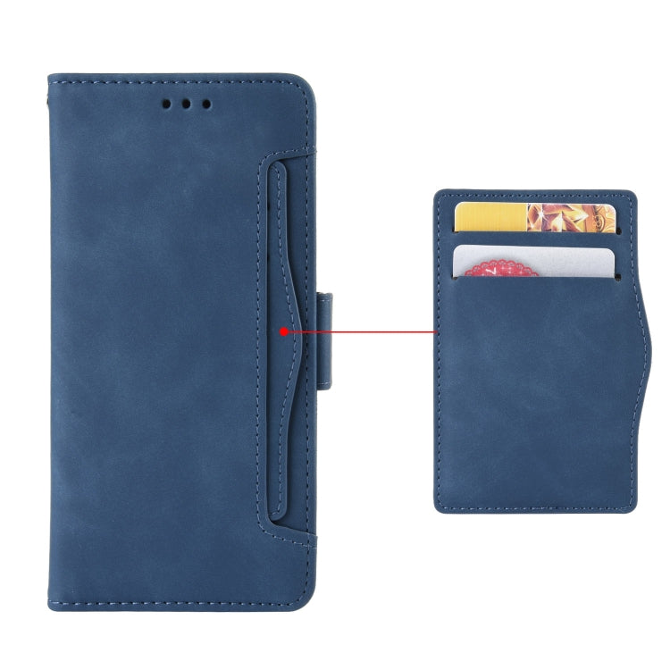 For Sony Xperia 10 VI 2024 Skin Feel Calf Texture Card Slots Leather Phone Case(Blue) - Sony Cases by buy2fix | Online Shopping UK | buy2fix