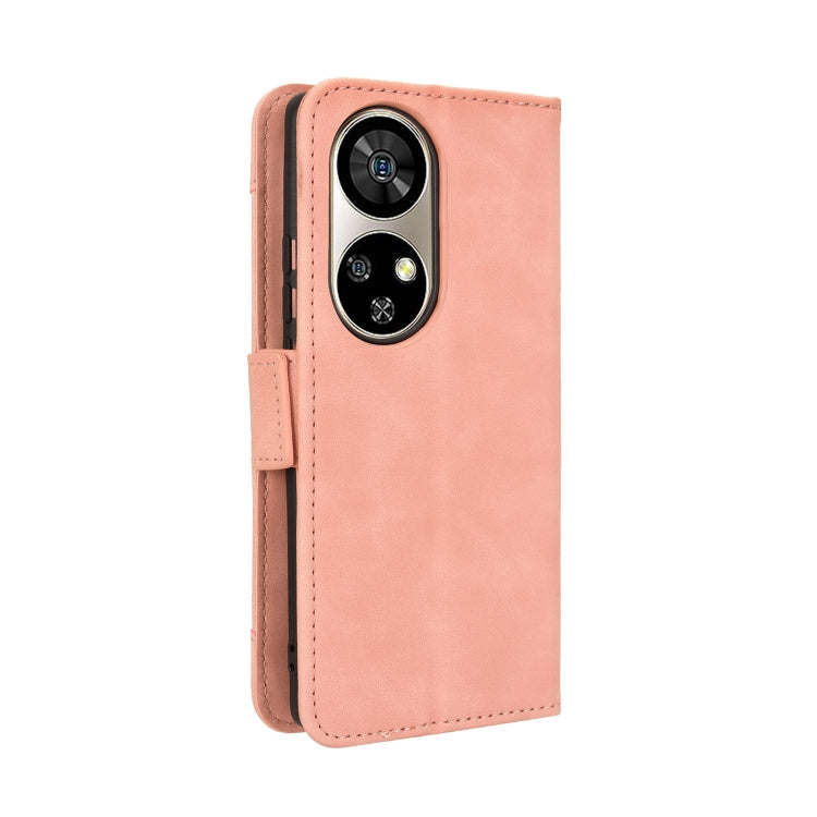 For Ulefone Note 17 Pro Skin Feel Calf Texture Card Slots Leather Phone Case(Pink) - Ulefone Cases by buy2fix | Online Shopping UK | buy2fix