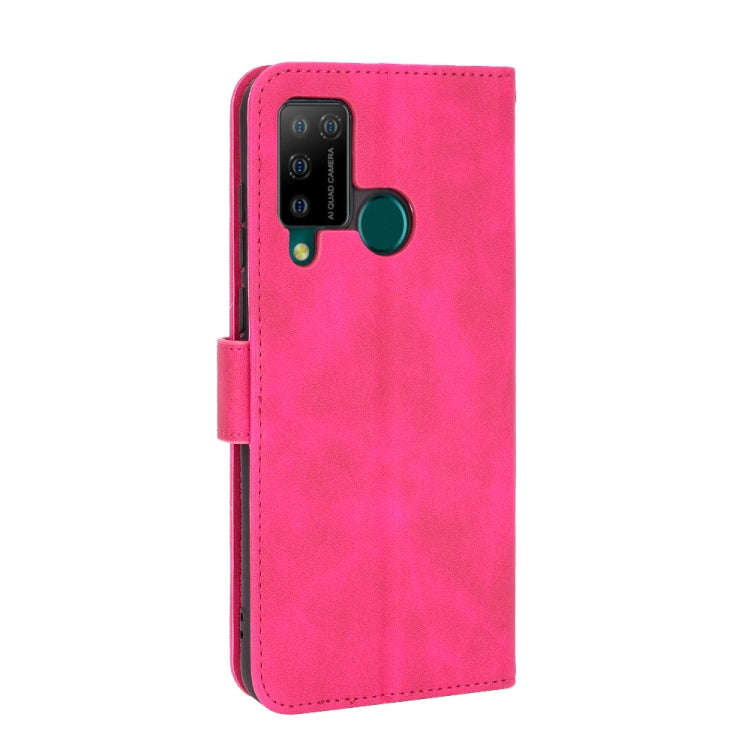 For DOOGEE N20 Pro Solid Color Skin Feel Magnetic Buckle Horizontal Flip Calf Texture PU Leather Case with Holder & Card Slots & Wallet(Rose Red) - More Brand by buy2fix | Online Shopping UK | buy2fix