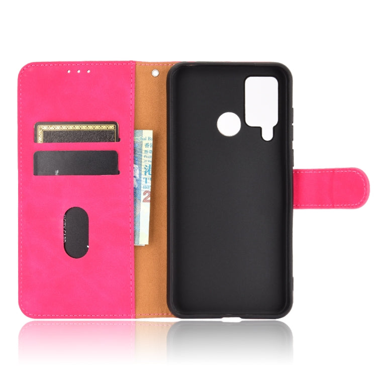 For DOOGEE N20 Pro Solid Color Skin Feel Magnetic Buckle Horizontal Flip Calf Texture PU Leather Case with Holder & Card Slots & Wallet(Rose Red) - More Brand by buy2fix | Online Shopping UK | buy2fix